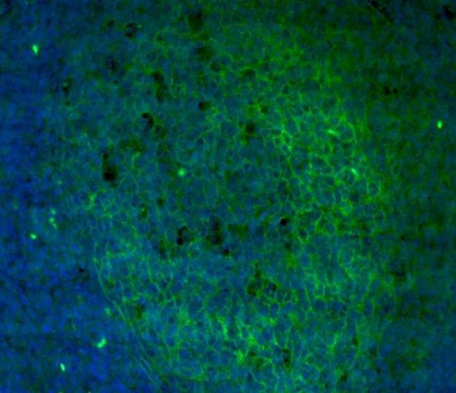 CD11b Antibody in Immunohistochemistry (Paraffin) (IHC (P))