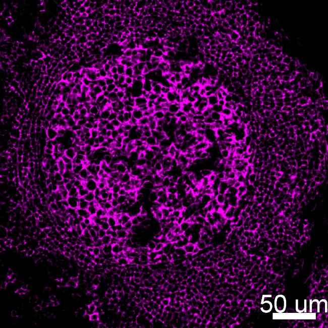 CD20 Antibody in Immunohistochemistry (IHC)