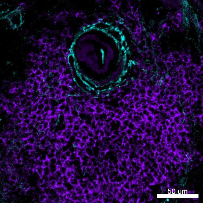 CD20 Antibody in Immunohistochemistry (IHC)