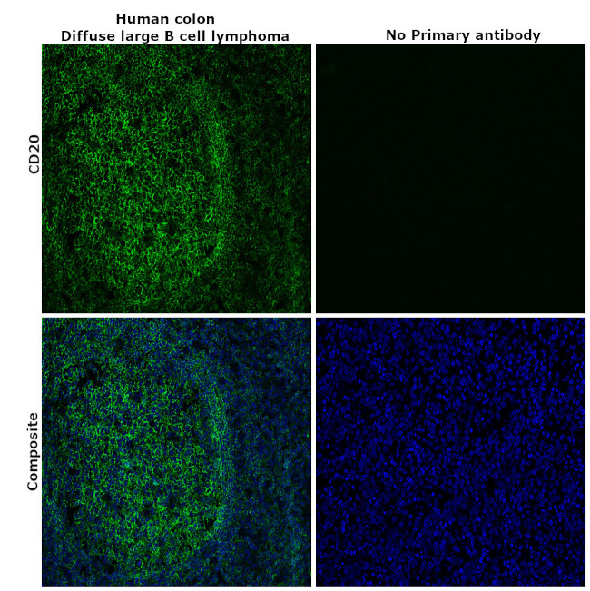 CD20 Antibody in Immunohistochemistry (Paraffin) (IHC (P))