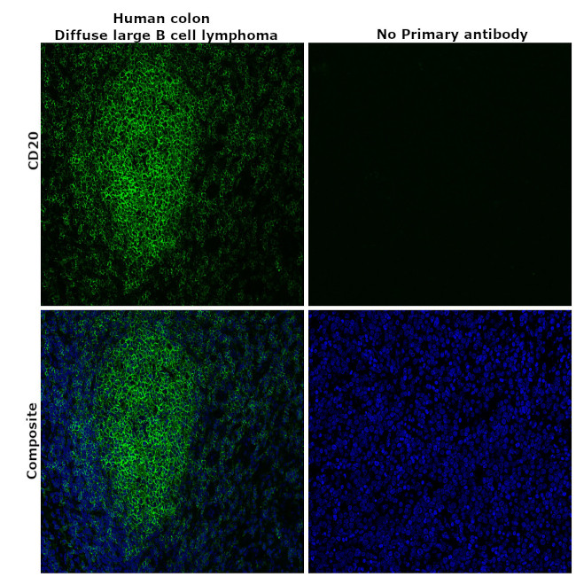 CD20 Antibody in Immunohistochemistry (Paraffin) (IHC (P))