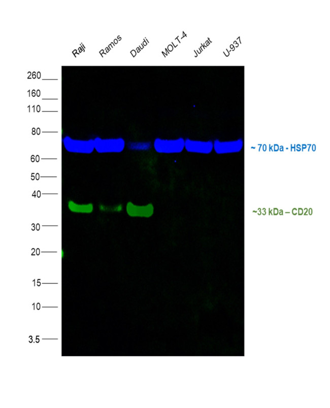 CD20 Antibody