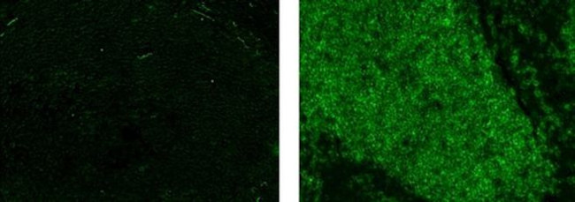 CD20 Antibody in Immunohistochemistry (Paraffin) (IHC (P))