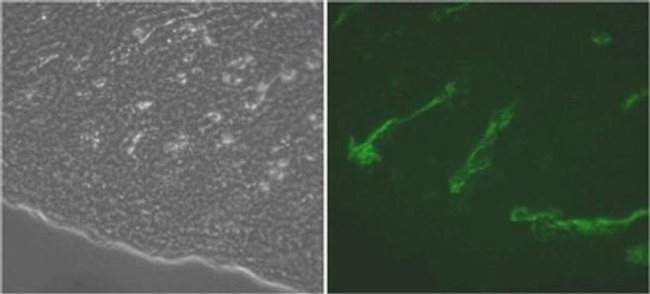 LYVE1 Antibody in Immunohistochemistry (Frozen) (IHC (F))