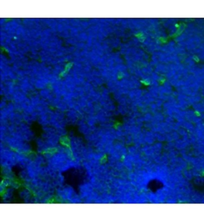 CD141 Antibody in Immunohistochemistry (Frozen) (IHC (F))