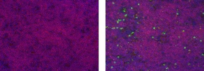 CD209a Antibody in Immunohistochemistry (Frozen) (IHC (F))