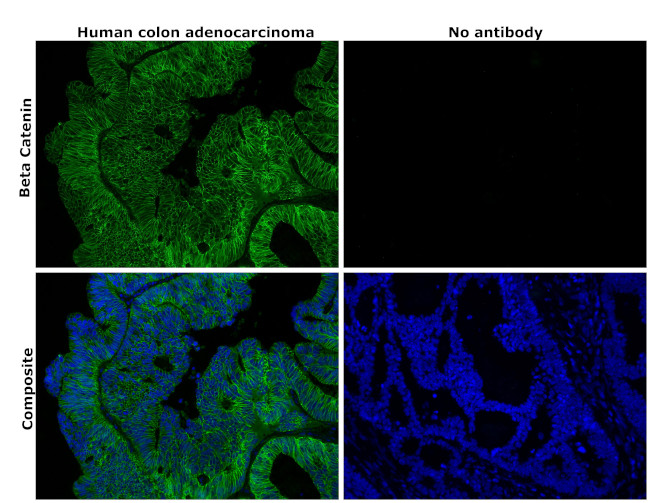 beta Catenin Antibody in Immunohistochemistry (Paraffin) (IHC (P))