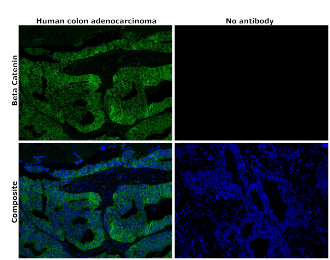 beta Catenin Antibody in Immunohistochemistry (Paraffin) (IHC (P))