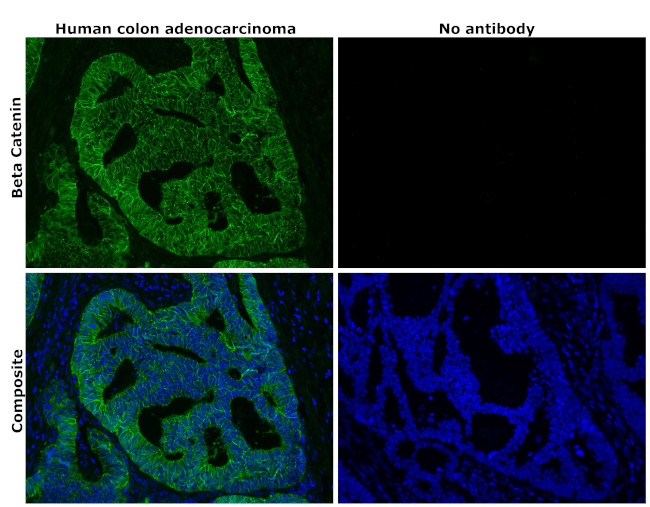 beta Catenin Antibody in Immunohistochemistry (Paraffin) (IHC (P))