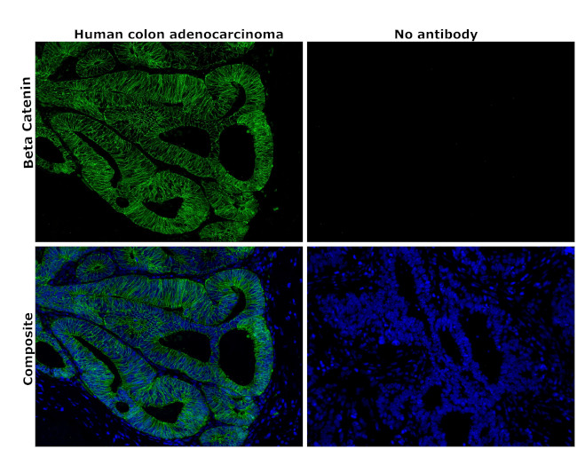 beta Catenin Antibody in Immunohistochemistry (Paraffin) (IHC (P))