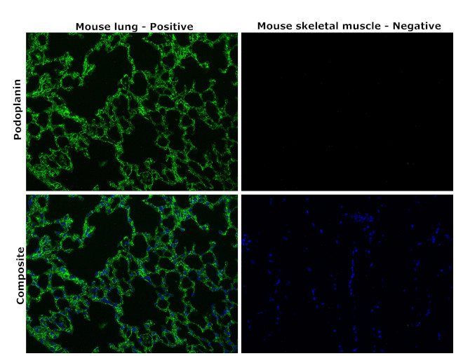 Podoplanin Antibody in Immunohistochemistry (Paraffin) (IHC (P))