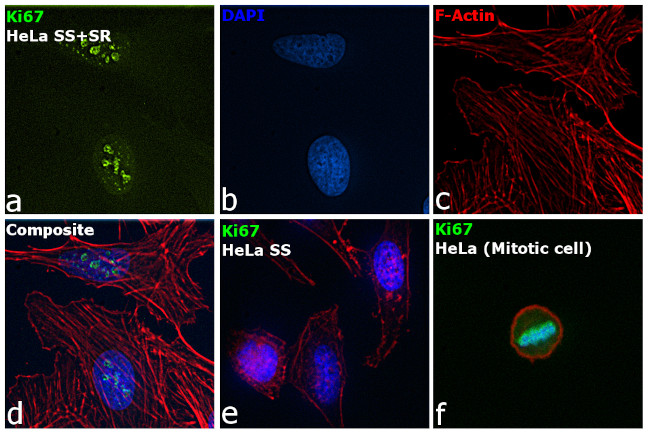 Ki-67 Antibody in Immunocytochemistry (ICC/IF)