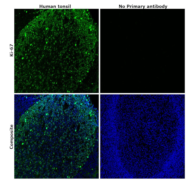 Ki-67 Antibody in Immunohistochemistry (Paraffin) (IHC (P))