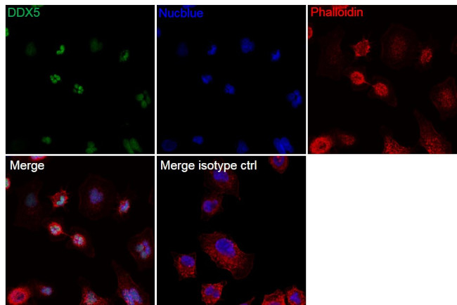 DDX5 Antibody in Immunocytochemistry (ICC/IF)