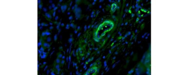 Smooth Muscle Myosin Antibody in Immunohistochemistry (Paraffin) (IHC (P))