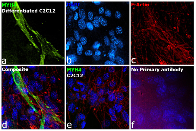 Myosin 4 Antibody in Immunocytochemistry (ICC/IF)