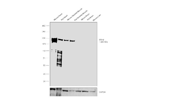 Myosin 4 Antibody in Western Blot (WB)