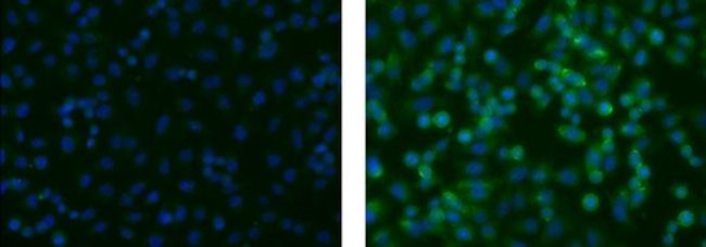 Neural/Glial Antigen 2 (NG2) Antibody in Immunocytochemistry (ICC/IF)