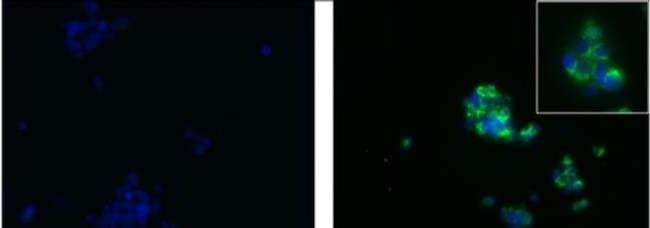 alpha-Fetoprotein Antibody in Immunocytochemistry (ICC/IF)