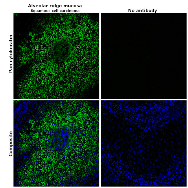 Pan Cytokeratin Antibody in Immunohistochemistry (Paraffin) (IHC (P))