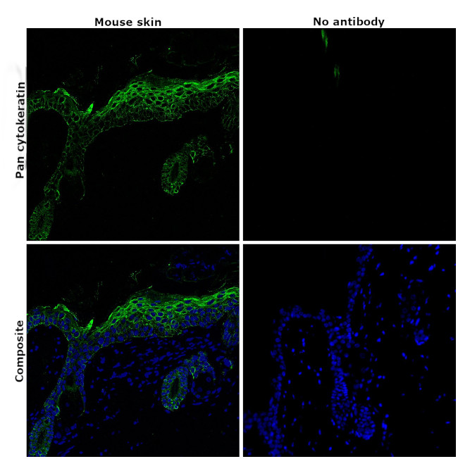 Pan Cytokeratin Antibody in Immunohistochemistry (Paraffin) (IHC (P))