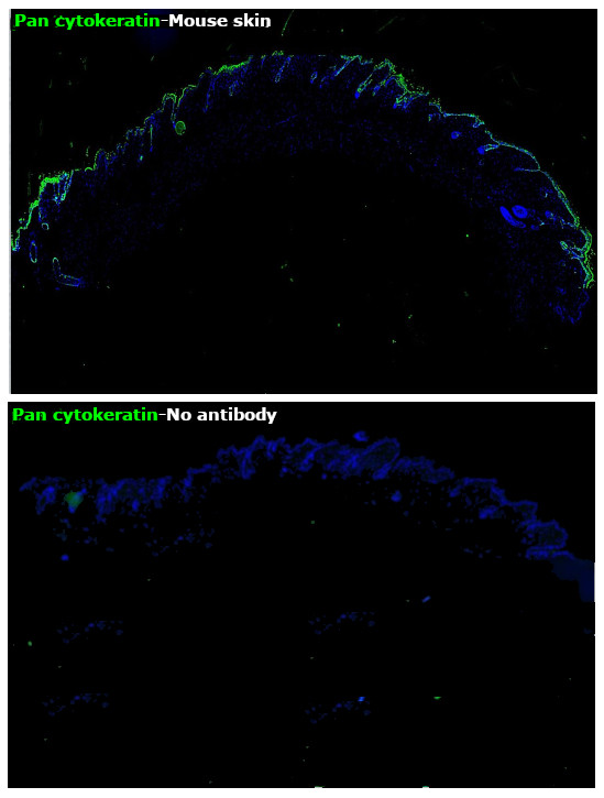 Pan Cytokeratin Antibody in Immunohistochemistry (Paraffin) (IHC (P))