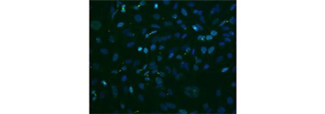 Survivin Antibody in Immunocytochemistry (ICC/IF)