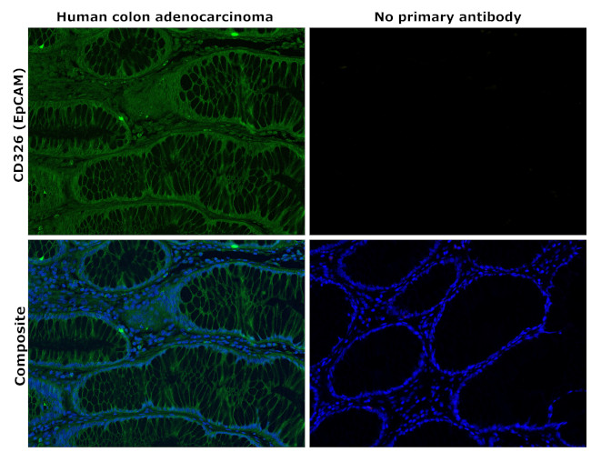 CD326 (EpCAM) Antibody in Immunohistochemistry (Paraffin) (IHC (P))