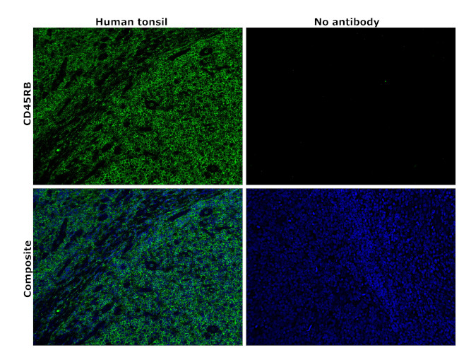 CD45RB Antibody in Immunohistochemistry (Paraffin) (IHC (P))