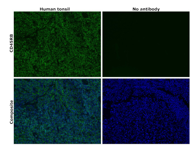 CD45RB Antibody in Immunohistochemistry (Paraffin) (IHC (P))