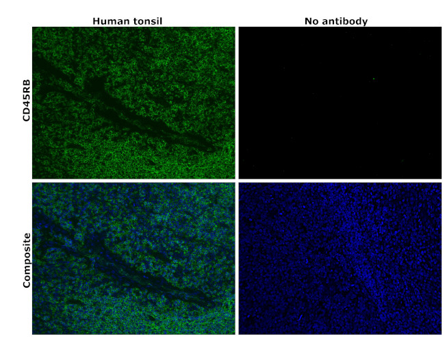 CD45RB Antibody in Immunohistochemistry (Paraffin) (IHC (P))