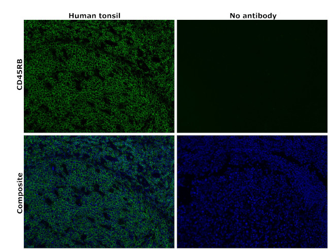 CD45RB Antibody in Immunohistochemistry (Paraffin) (IHC (P))