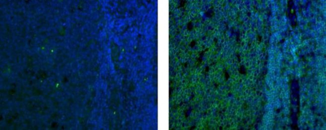 CD45RB Antibody in Immunohistochemistry (Paraffin) (IHC (P))