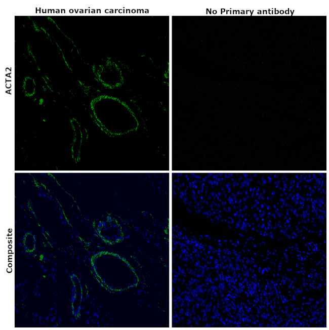 Alpha-Smooth Muscle Actin Antibody in Immunohistochemistry (Paraffin) (IHC (P))