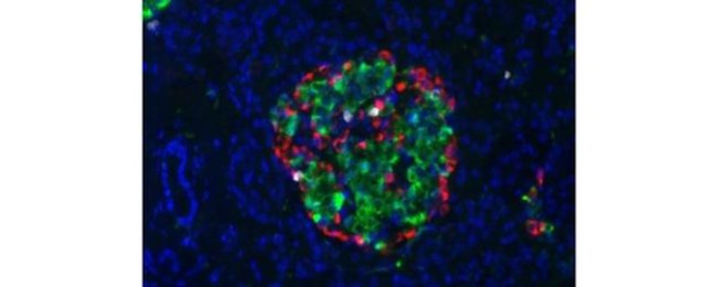 Insulin Antibody in Immunohistochemistry (Paraffin) (IHC (P))