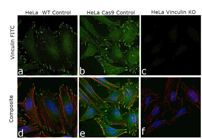 Vinculin Antibody in Immunocytochemistry (ICC/IF)