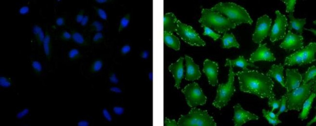 Vinculin Antibody in Immunocytochemistry (ICC/IF)