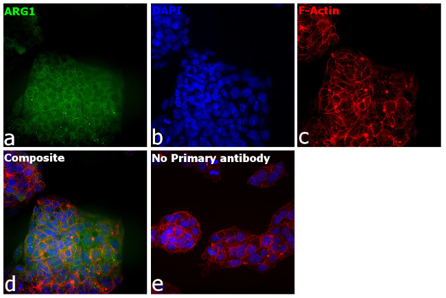 Arginase 1 Antibody in Immunocytochemistry (ICC/IF)