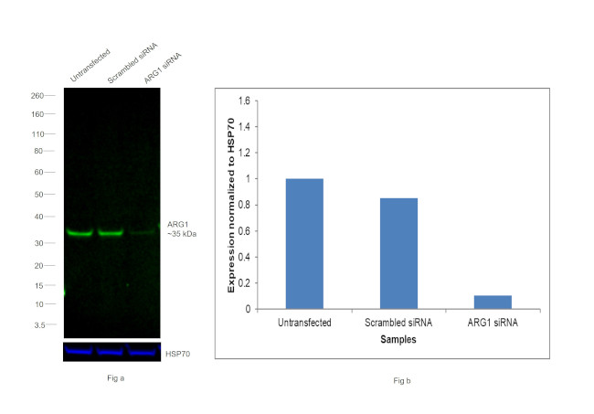 Arginase 1 Antibody