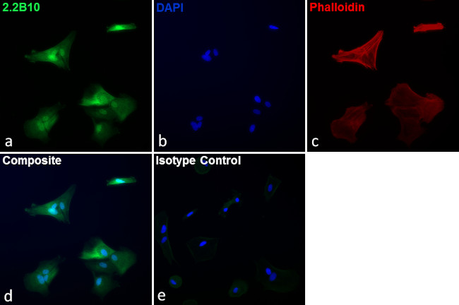 GFAP Antibody in Immunocytochemistry (ICC/IF)