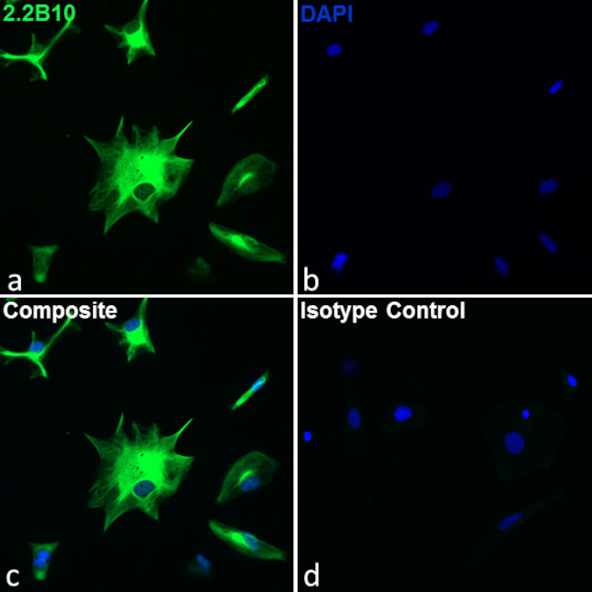 GFAP Antibody in Immunocytochemistry (ICC/IF)