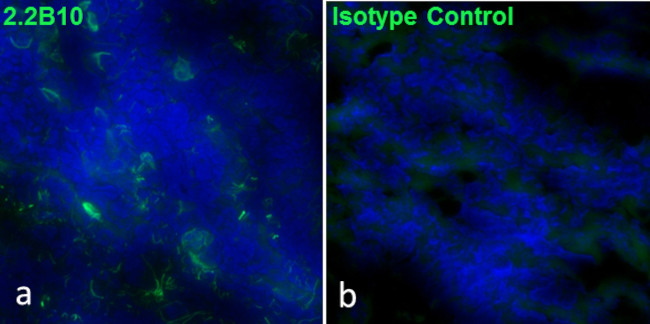 GFAP Antibody in Immunohistochemistry (Frozen) (IHC (F))