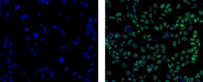 SOX2 Antibody in Immunocytochemistry (ICC/IF)