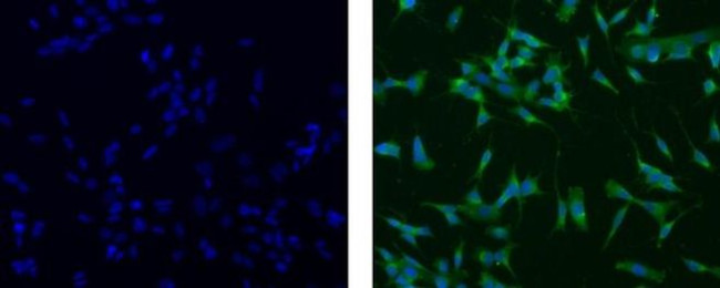 Nestin Antibody in Immunocytochemistry (ICC/IF)