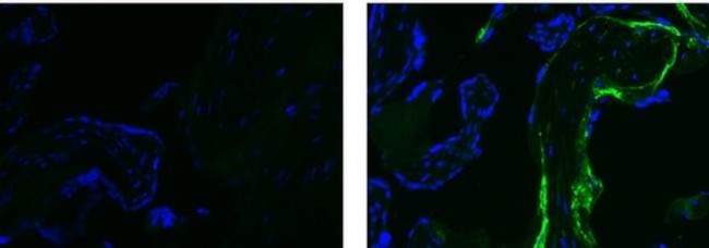 Fibronectin Antibody in Immunohistochemistry (Paraffin) (IHC (P))