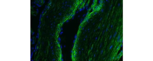 Collagen IV Antibody in Immunohistochemistry (Paraffin) (IHC (P))