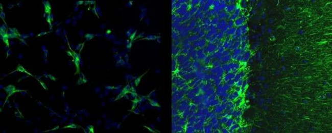 GFAP Antibody in Immunocytochemistry (ICC/IF)