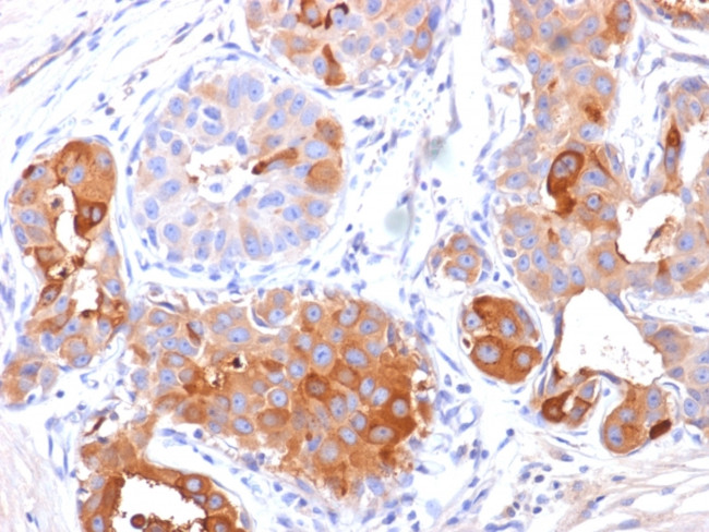 GCDFP-15 Antibody in Immunohistochemistry (Paraffin) (IHC (P))