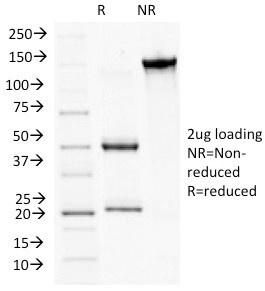 Plakophilin-1 (PKP1) Antibody in SDS-PAGE (SDS-PAGE)