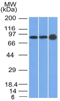 Plakophilin-1 (PKP1) Antibody in Western Blot (WB)